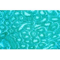 人子宫内膜腺癌细胞；HEC-1-A	